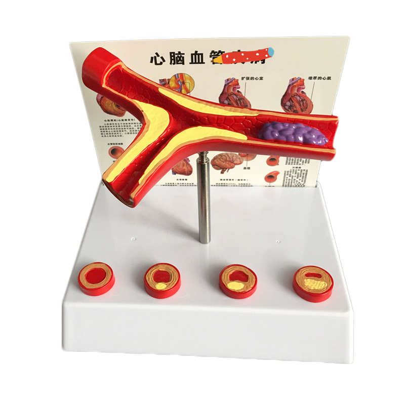 50 Times Enlarged Human Vessel - Medical Lab And Science reseña y precio